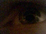 The eye